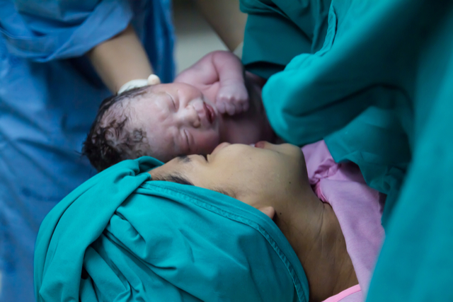  Understanding Caesarean and What to Expect